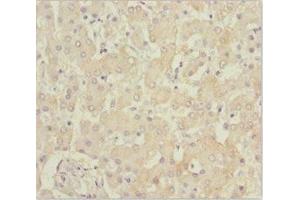 Immunohistochemistry of paraffin-embedded human liver tissue using ABIN7145187 at dilution of 1:100