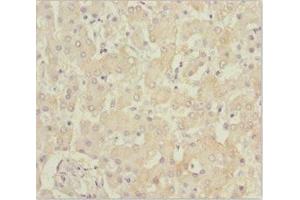 Immunohistochemistry of paraffin-embedded human liver tissue using ABIN7145187 at dilution of 1:100 (B9D1 anticorps  (AA 1-130))