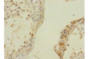 Immunohistochemistry of paraffin-embedded human testis tissue using ABIN7176393 at dilution of 1:100 (ZNF564 anticorps  (AA 1-200))