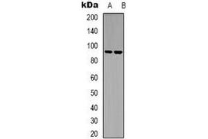 Western blot analysis of LTK expression in Raji (A), Jurkat (B) whole cell lysates. (LTK anticorps)