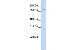 WB Suggested Anti-ATF6 Antibody Titration: 0. (ATF6 anticorps  (N-Term))