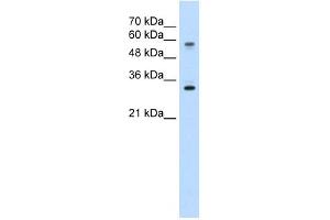 SLC22A1 antibody used at 5 ug/ml to detect target protein.