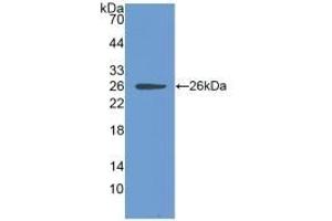 Detection of Recombinant CLIC1, Human using Polyclonal Antibody to Chloride Intracellular Channel Protein 1 (CLIC1) (CLIC1 anticorps  (AA 79-241))