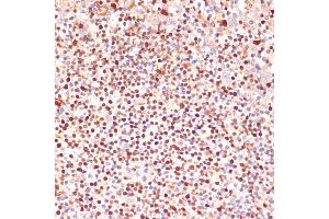 Immunohistochemistry of paraffin-embedded human tonsil using  antibody (ABIN3023072, ABIN3023073, ABIN3023074 and ABIN6219376) at dilution of 1:100 (40x lens). (ALOX5 anticorps  (AA 1-300))