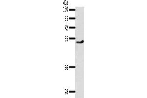 Gel: 10 % SDS-PAGE, Lysate: 40 μg, Lane: Mouse heart tissue, Primary antibody: ABIN7191971(PPARD Antibody) at dilution 1/500, Secondary antibody: Goat anti rabbit IgG at 1/8000 dilution, Exposure time: 30 seconds (PPARD anticorps)