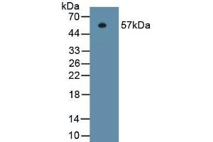 Detection of Recombinant ITGb1, Human using Monoclonal Antibody to Integrin Beta 1 (ITGb1) (ITGB1 anticorps  (AA 140-383))