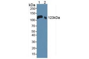 Western blot analysis of (1) Mouse Serum and (2) Mouse Placenta Tissue. (LIFR anticorps  (AA 381-485))