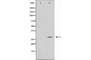 Western blot analysis on Jurkat cell lysate using GADD153 Antibody,The lane on the left is treated with the antigen-specific peptide. (DDIT3 anticorps  (N-Term))