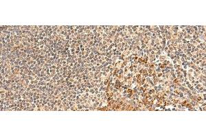 Immunohistochemistry of paraffin-embedded Human tonsil tissue using GALNT12 Polyclonal Antibody at dilution of 1:60(x200) (GALNT12 anticorps)