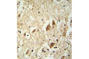 Immunohistochemistry analysis in formalin fixed and paraffin embedded human brain tissue reacted with KATNAL1 Antibody (N-term) followed which was peroxidase conjugated to the secondary antibody and followed by DAB staining. (KATNAL1 anticorps  (N-Term))