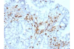 Formalin-fixed, paraffin-embedded human Colon stained with CD103 Mouse Monoclonal Antibody (ITGAE/2063). (CD103 anticorps)