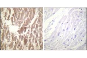 Immunohistochemistry analysis of paraffin-embedded human heart, using TNNI3 (Phospho-Ser43) Antibody.