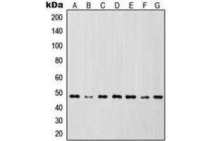 Western blot analysis of IKK gamma expression in Jurkat (A), HL60 (B), HeLa (C), NIH3T3 (D), Raw264.