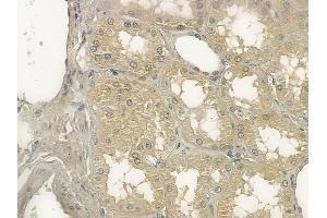 ABIN6257237 and ABIN6273355 at 1/100 staining human normal kidney tissue by IHC-P. (GEM anticorps  (N-Term))
