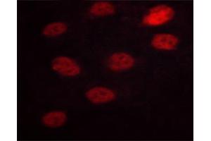 ABIN6267629 staining HeLa cells by ICC/IF. (NFATC3 anticorps  (pSer165))