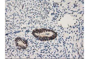 Image no. 10 for anti-Nonhomologous End-Joining Factor 1 (NHEJ1) antibody (ABIN1499729) (NHEJ1 anticorps)