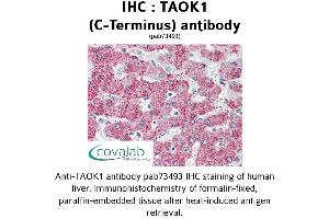 Image no. 2 for anti-TAO Kinase 1 (TAOK1) (C-Term) antibody (ABIN1739898) (TAO Kinase 1 (TAOK1) (C-Term) anticorps)