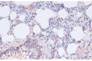 Immunohistochemistry of paraffin-embedded Rat lung using VASP Polyclonal Antibody at dilution of 1:100 (40x lens). (VASP anticorps)