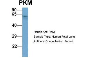Host: Rabbit  Target Name: PKM  Sample Tissue: Human Fetal Lung  Antibody Dilution: 1. (PKM2 anticorps  (Middle Region))