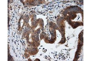 Immunohistochemical staining of paraffin-embedded liver tissue using anti-KIAA1609 mouse monoclonal antibody. (KIAA1609 anticorps)
