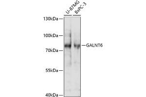 Western blot analysis of extracts of various cell lines, using G antibody (ABIN7271209) at 1:1000 dilution. (GALNT6 anticorps  (AA 30-140))