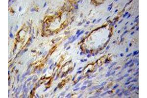 Immunohistochemistry of paraffin-embedded H-ovary using PPARG Antibody at Dilution 1:100