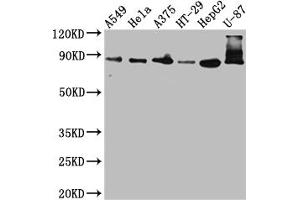 Western Blot Positive WB detected in: A549 whole cell lysate, Hela whole cell lysate, A375 whole cell lysate, HT-29 whole cell lysate, HepG2 whole cell lysate, U-87 whole cell lysate All lanes: Furin antibody at 1:1000 Secondary Goat polyclonal to rabbit IgG at 1/50000 dilution Predicted band size: 87 kDa Observed band size: 87, 72 kDa (Recombinant FURIN anticorps)