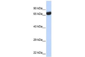 TPTE antibody used at 1 ug/ml to detect target protein. (TPTE anticorps  (Middle Region))