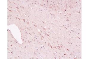 Formalin-fixed and paraffin embedded rat brain labeled with Rabbit Anti-Tyrosine Hydroxylase(Neuronal Marker)/Tyk2/TYH Polyclonal Antibody, Unconjugated  1:200 followed by conjugation to the secondary antibody and DAB staining