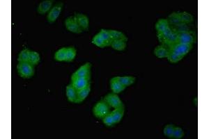 Immunofluorescent analysis of HepG2 cells using ABIN7163092 at dilution of 1:100 and Alexa Fluor 488-congugated AffiniPure Goat Anti-Rabbit IgG(H+L)
