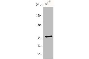 Western Blot analysis of HeLa cells using MRTF-A Polyclonal Antibody (MKL1 anticorps  (N-Term))