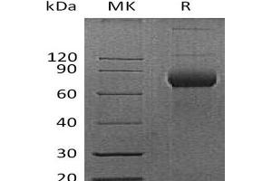 Western Blotting (WB) image for CD38 protein (Fc Tag) (ABIN7320857) (CD38 Protein (Fc Tag))