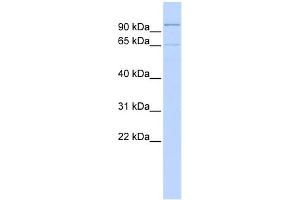 WB Suggested Anti-ZNF30 Antibody Titration:  0.