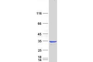 Validation with Western Blot