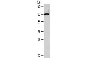Western Blotting (WB) image for anti-Carnitine Palmitoyltransferase 2 (CPT2) antibody (ABIN2425697) (CPT2 anticorps)