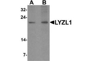 Western blot analysis of LYZL1 in A20 cell lysate with LYZL1 Antibody  at (A) 1 and (B) 2 ug/mL. (Lysozyme-Like 1 anticorps  (N-Term))