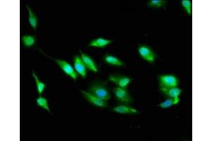 Immunofluorescence staining of Hela cells with ABIN7168982 at 1:100, counter-stained with DAPI.