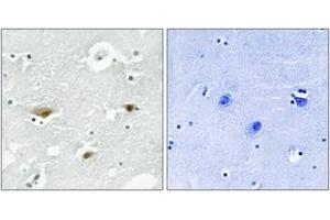 Immunohistochemistry analysis of paraffin-embedded human brain, using STK39 (Phospho-Ser325) Antibody. (STK39 anticorps  (pSer325))