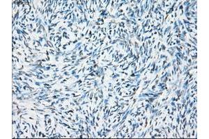 Image no. 9 for anti-Crystallin, alpha B (CRYAB) antibody (ABIN1497647)