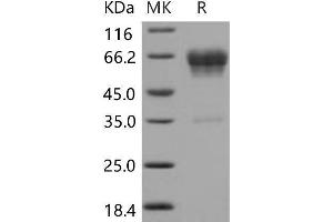 Western Blotting (WB) image for CD99 Molecule-Like 2 (CD99L2) protein (Fc Tag) (ABIN7320249)