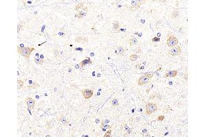Immunohistochemistry analysis of paraffin-embedded mouse spinal marrow using NTRK2 Polyclonal Antibody at dilution of 1:400. (TRKB anticorps)