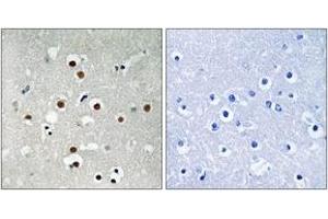 Immunohistochemistry analysis of paraffin-embedded human brain, using MEF2C (Phospho-Ser396) Antibody. (MEF2C anticorps  (pSer396))