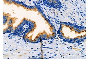 anti-Cyclin-dependent kinases regulatory subunit 2 (CKS2) (Internal Region) antibody
