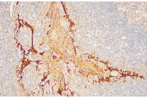 Immunohistochemistry of paraffin-embedded Human tonsil using SERPINB2 Polycloanl Antibody at dilution of 1:200 (SERPINB2 anticorps)