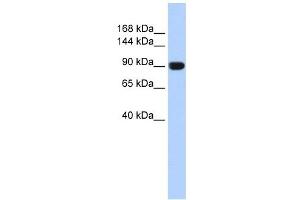 TMEM16A antibody used at 1 ug/ml to detect target protein. (ANO1 anticorps  (Middle Region))