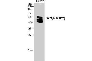 Western Blotting (WB) image for anti-Ubiquitin (Ubiquitin) (acLys27) antibody (ABIN3181496) (Ubiquitin anticorps  (acLys27))
