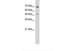 Image no. 1 for anti-Zinc Finger Protein 821 (ZNF821) (C-Term) antibody (ABIN6736303) (ZNF821 anticorps  (C-Term))