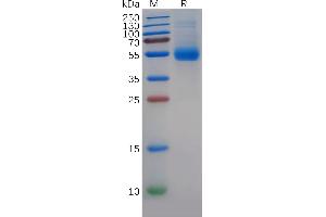 Human MIF Protein, hFc Tag on SDS-PAGE under reducing condition.