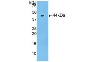 Detection of Recombinant PIP, Mouse using Polyclonal Antibody to Prolactin Induced Protein (PIP) (PIP anticorps  (AA 1-146))