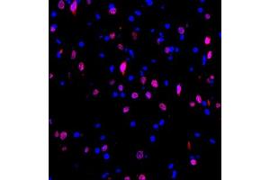 Immunofluorescence of paraffin embedded rat brain using HRP3 (ABIN7074198) at dilution of 1:1000 (400x lens)